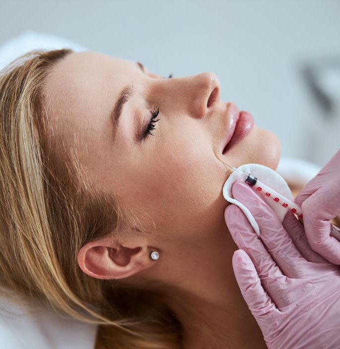 Treatment of Nasolabial Folds