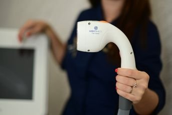 laser hair removal