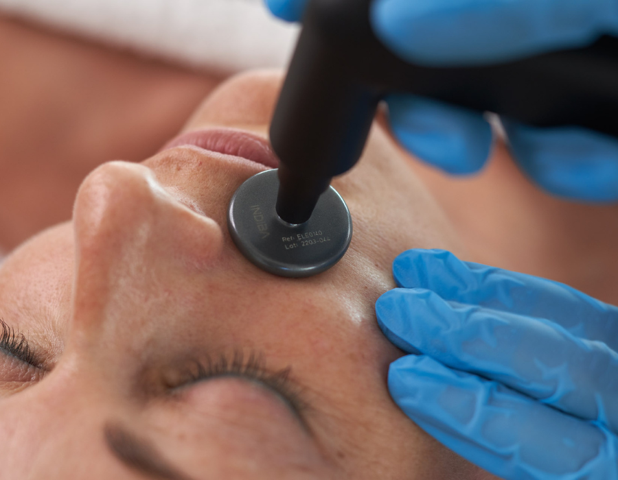 indiba-facial